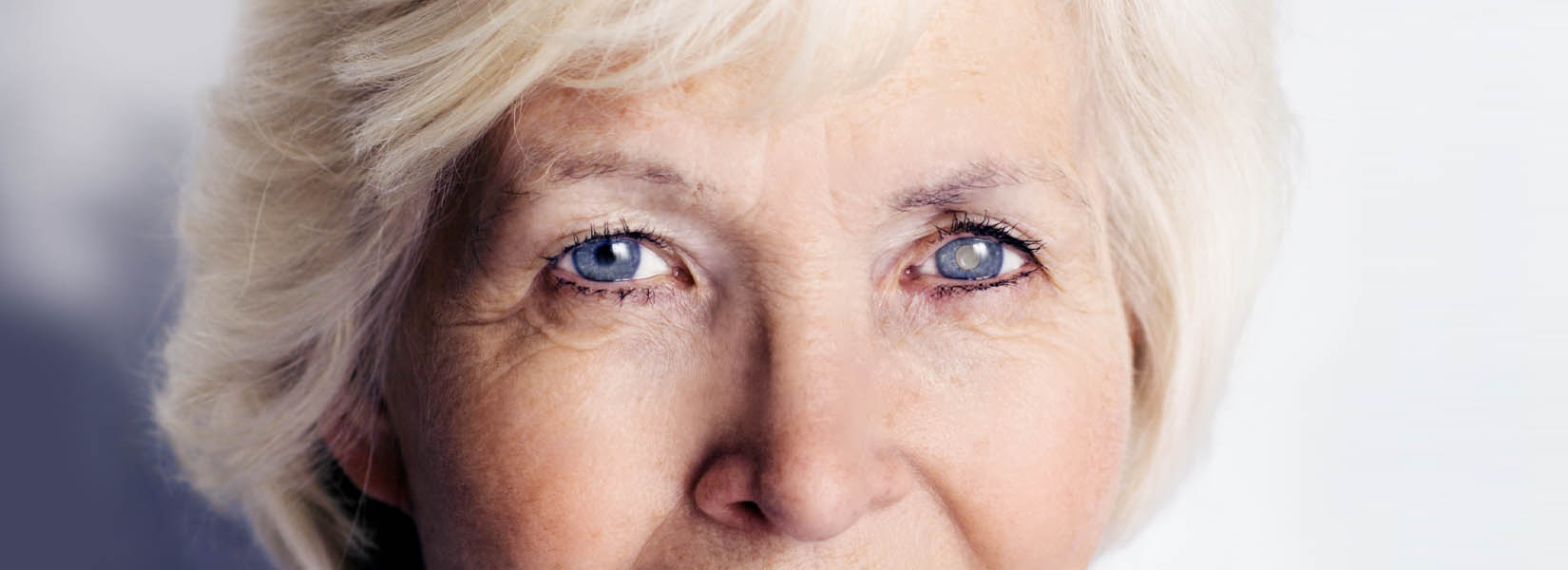 Cataract Surgery in Marysville