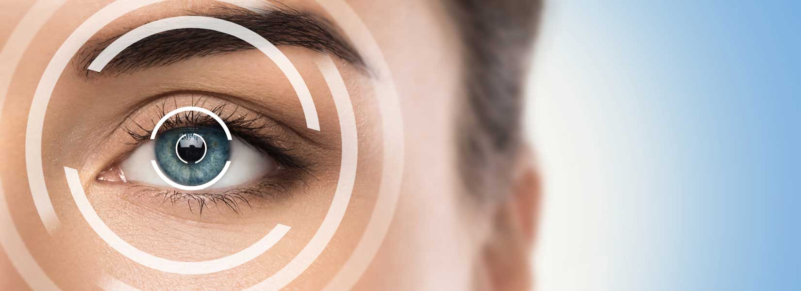 LASIK & Refractive Surgery Co-Management in Marysville